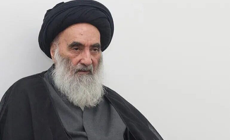 حکم آیت الله سیستانی در مورد کاشت ابرو و خالکوبی 1