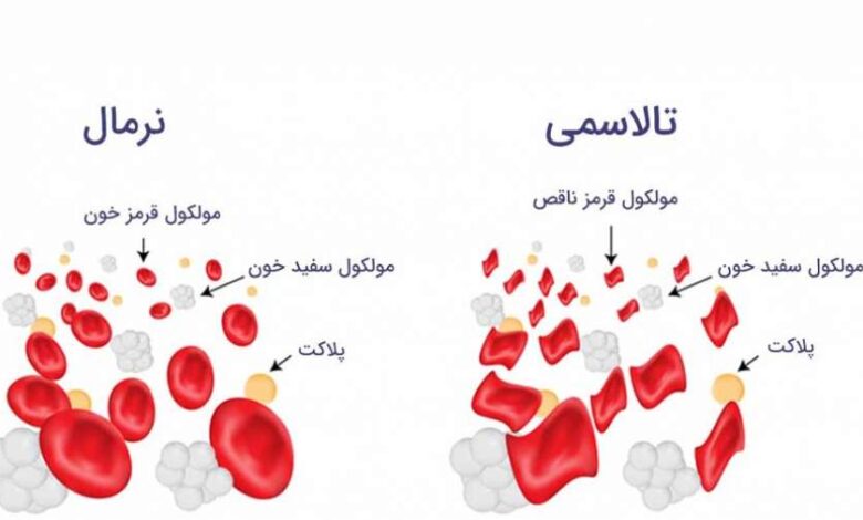 قبل از ازدواج فامیلی این آزمایش را جدی بگیرید 1 ازدواج فامیلی
