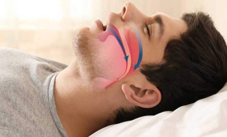 کاهش احتمال ابتلا به پارکینسون با درمان آپنه خواب 1 پارکینسون