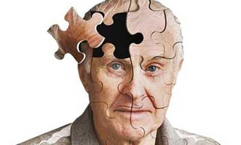 علائم ابتلا به آلزایمر از چند سنی شروع میشود؟ 1 آلزایمر